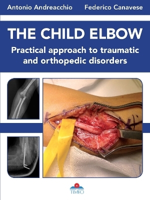 The Child Elbow - Florence Muller, Thomas Wirth, Christina Steiger