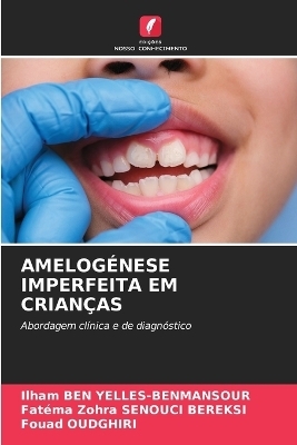 Amelogénese Imperfeita Em Crianças - Ilham BEN YELLES-BENMANSOUR, Fatéma Zohra SENOUCI BEREKSI, Fouad OUDGHIRI