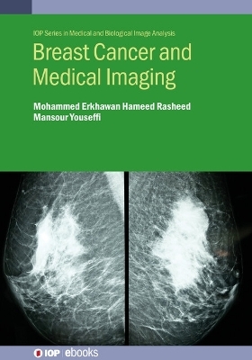 Breast Cancer and Medical Imaging - Mohammed Erkhawan Hameed Rasheed, Mansour Youseffi