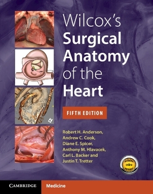 Wilcox's Surgical Anatomy of the Heart - Robert H. Anderson, Andrew C. Cook, Diane E. Spicer, Anthony M. Hlavacek, Carl L. Backer