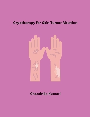 Cryotherapy for Skin Tumor Ablation - Chandrika Kumari