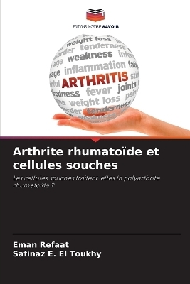 Arthrite rhumato�de et cellules souches - Eman Refaat, Safinaz E El Toukhy