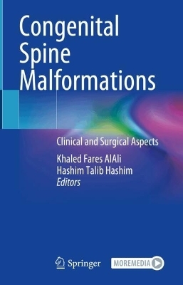 Congenital Spine Malformations - 