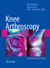 Knee Arthroscopy - 
