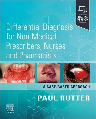 Differential Diagnosis for Non-medical Prescribers, Nurses and Pharmacists: A Case-Based Approach - Paul Rutter