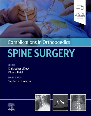 Complications in Orthopaedics: Spine Surgery - 