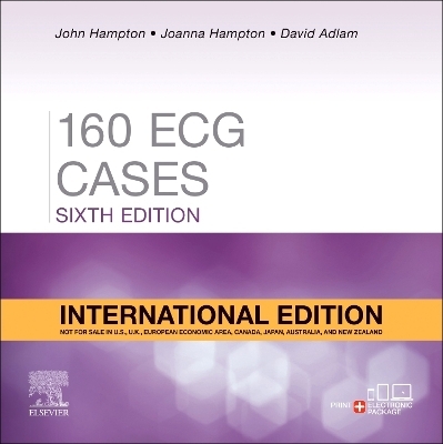 150 ECG Cases, International Edition - John Hampton, Joanna Hampton, David Adlam