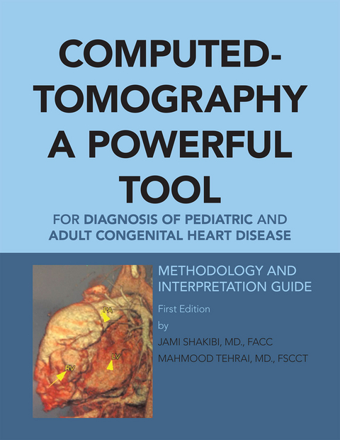 Computed-Tomography a Powerful Tool for Diagnosis of Pediatric and Adult Congenital Heart Disease - Jami G. Shakibi