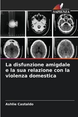 La disfunzione amigdale e la sua relazione con la violenza domestica - Ashlie Castaldo