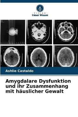 Amygdalare Dysfunktion und ihr Zusammenhang mit h�uslicher Gewalt - Ashlie Castaldo