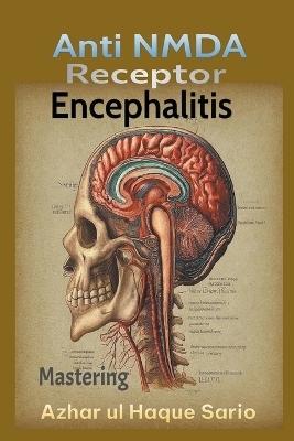 Mastering Anti NMDA Receptor Encephalitis - Azhar Ul Haque Sario