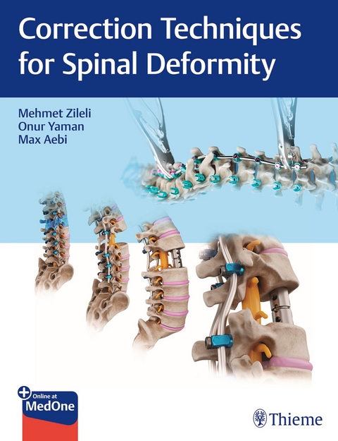 Correction Techniques for Spinal Deformity - 