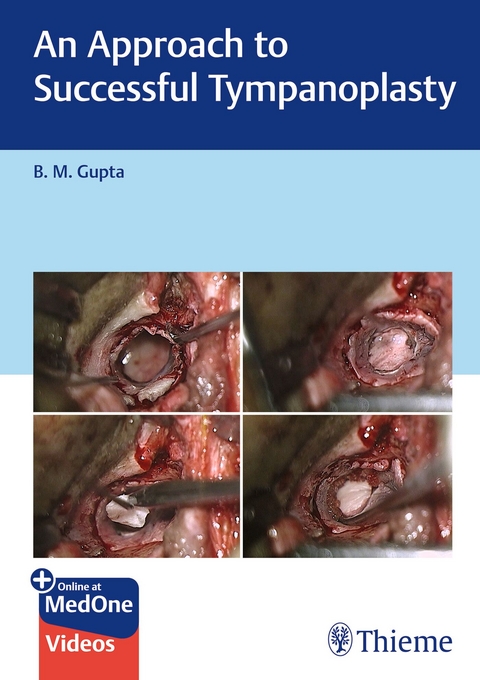 An Approach to Successful Tympanoplasty - B. M. Gupta