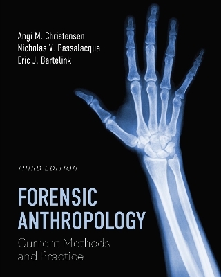 Forensic Anthropology - Angi M. Christensen, Nicholas V. Passalacqua, Eric J. Bartelink
