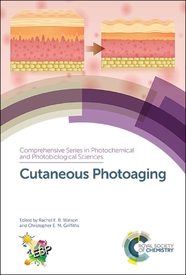 Cutaneous Photoaging - 