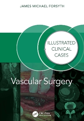 Vascular Surgery: - James Forsyth