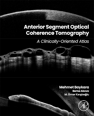 Anterior Segment Optical Coherence Tomography - 