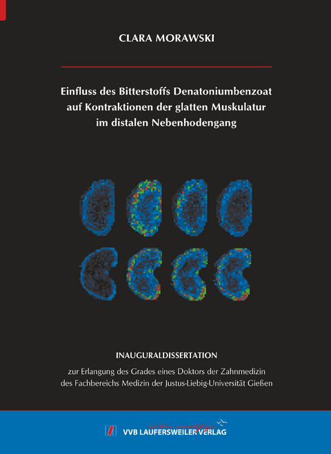 Einfluss des Bitterstoffs Denatoniumbenzoat auf Kontraktionen der glatten Muskulatur im distalen Nebenhodengang - Clara Morawski