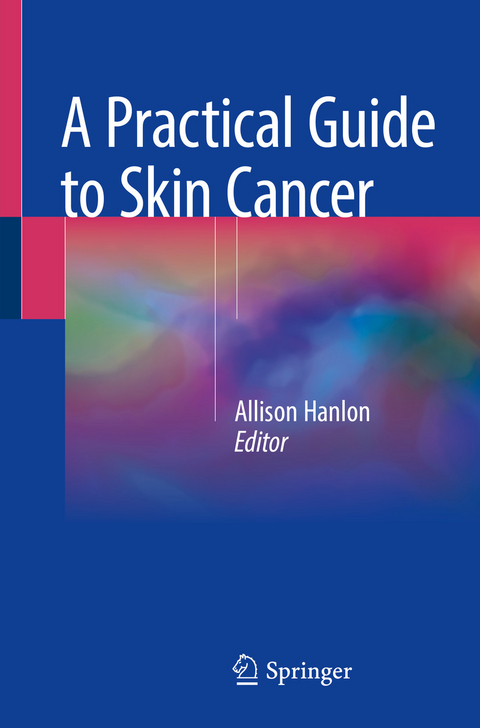 A Practical Guide to Skin Cancer - 
