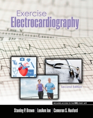 Exercise Electrocardiography - STANLEY BROWN, Cameron Huxford, Leeann Joe