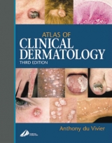 Atlas of Clinical Dermatology - du Vivier, Anthony