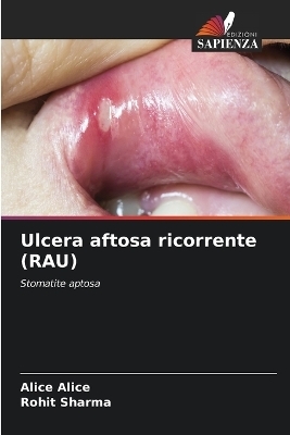 Ulcera aftosa ricorrente (RAU) - Alice Alice, Rohit Sharma