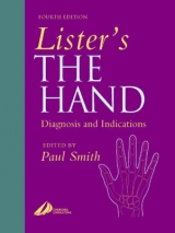 Lister's the Hand - Smith, Paul