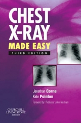 Chest X-Ray Made Easy - Corne, Jonathan; Pointon, Kate