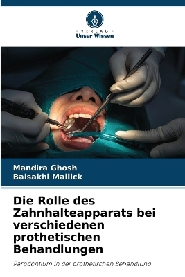 Die Rolle des Zahnhalteapparats bei verschiedenen prothetischen Behandlungen - Mandira Ghosh, BAISAKHI MALLICK