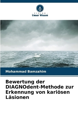 Bewertung der DIAGNOdent-Methode zur Erkennung von kari�sen L�sionen - Mohammad Bamzahim