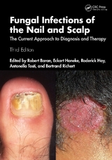 Fungal Infections of the Nail and Scalp - Baran, Robert; Haneke, Eckart; Hay, Roderick; Tosti, Antonella; Richert, Bertrand