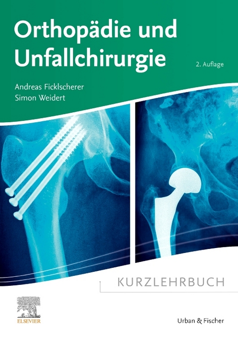 Kurzlehrbuch Orthopädie und Unfallchirurgie - Andreas Ficklscherer, Simon Weidert