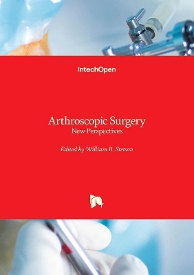 Arthroscopic Surgery - 