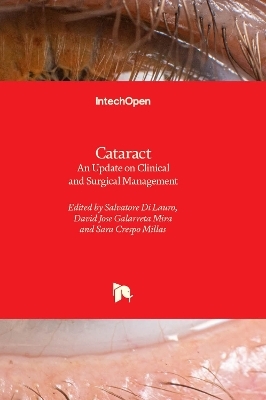 Cataract - 