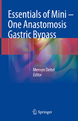 Essentials of Mini — One Anastomosis Gastric Bypass - 