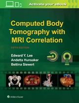 Computed Body Tomography with MRI Correlation - Lee, Edward Y.; Hunsaker, Andetta; Siewert, Bettina