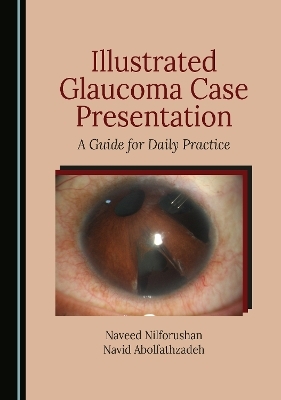 Illustrated Glaucoma Case Presentation - 