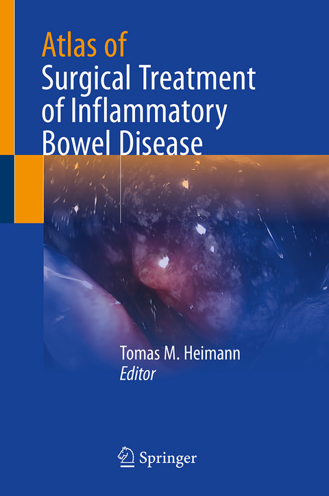 Atlas of Surgical Treatment of Inflammatory Bowel Disease - 