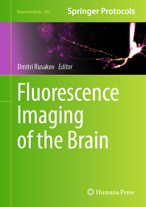 Fluorescence Imaging of the Brain - 