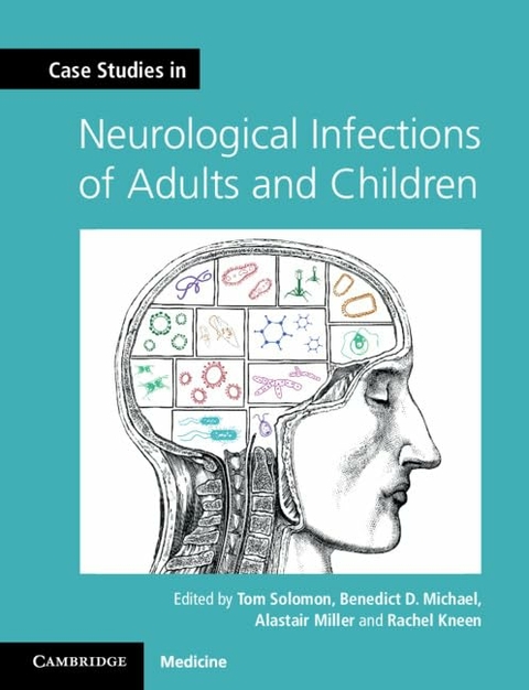 Case Studies in Neurological Infections of Adults and Children - 