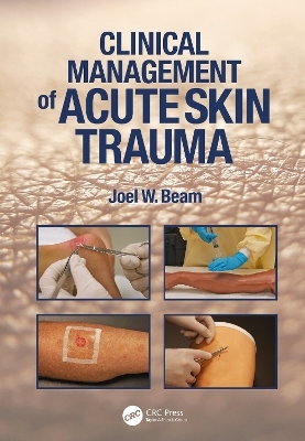 Clinical Management of Acute Skin Trauma - Joel W. Beam