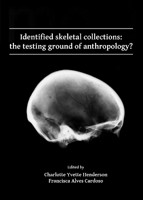 Identified skeletal collections: the testing ground of anthropology? - 