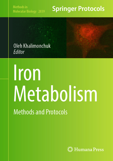 Iron Metabolism - 