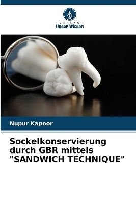 Sockelkonservierung durch GBR mittels "SANDWICH TECHNIQUE" - Nupur Kapoor