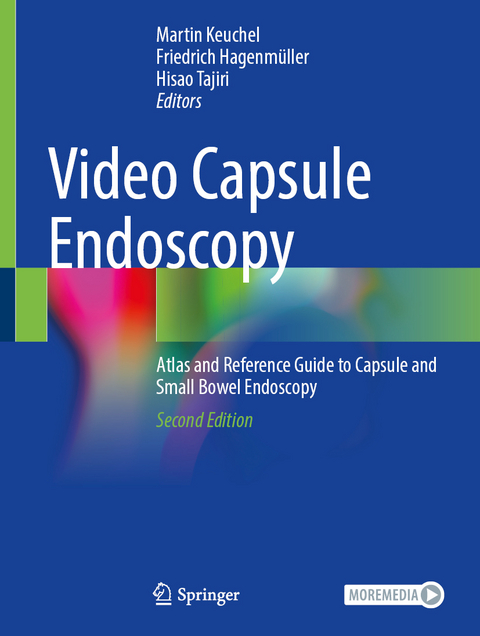 Video Capsule Endoscopy - 