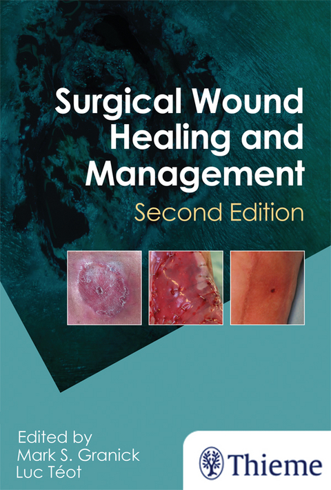 Surgical Wound Healing and Management - 