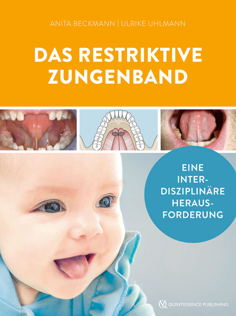 Das restriktive Zungenband - 