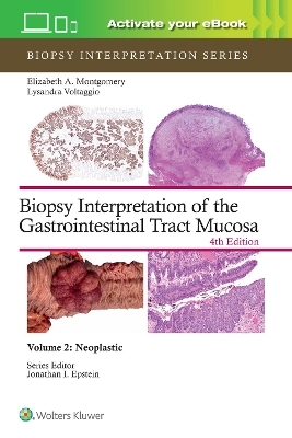 Biopsy Interpretation of the Gastrointestinal Tract Mucosa Volume 2 - ELIZABETH ANNE MONTGOMERY, Lysandra Voltaggio