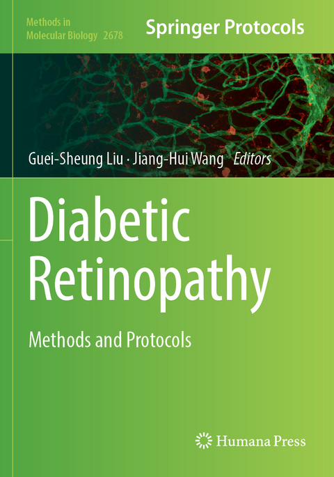 Diabetic Retinopathy - 