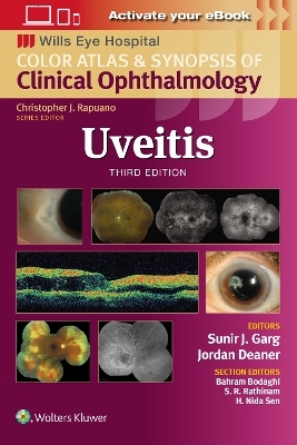 Uveitis - Sunir J. Garg